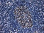 DLD Antibody in Immunohistochemistry (Paraffin) (IHC (P))