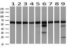 DLD Antibody in Western Blot (WB)