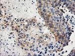 ANAPC2 Antibody in Immunohistochemistry (Paraffin) (IHC (P))