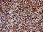 CYP17A1 Antibody in Immunohistochemistry (Paraffin) (IHC (P))