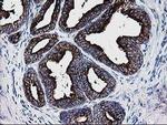 DTYMK Antibody in Immunohistochemistry (Paraffin) (IHC (P))