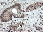 PNPO Antibody in Immunohistochemistry (Paraffin) (IHC (P))