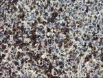 UNG Antibody in Immunohistochemistry (Paraffin) (IHC (P))