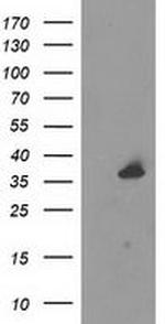 UNG Antibody in Western Blot (WB)