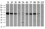 GBP1 Antibody in Western Blot (WB)