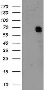 GTF2F1 Antibody in Western Blot (WB)