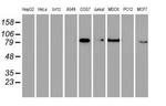 GTF2F1 Antibody in Western Blot (WB)