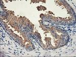 ACSS2 Antibody in Immunohistochemistry (Paraffin) (IHC (P))