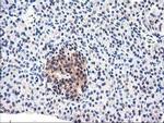 CYP2J2 Antibody in Immunohistochemistry (Paraffin) (IHC (P))