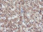 CYP2J2 Antibody in Immunohistochemistry (Paraffin) (IHC (P))