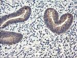 CYP2J2 Antibody in Immunohistochemistry (Paraffin) (IHC (P))