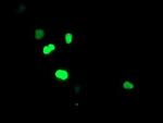 SIRT6 Antibody in Immunocytochemistry (ICC/IF)