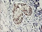 SERPINB13 Antibody in Immunohistochemistry (Paraffin) (IHC (P))