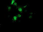 AIPL1 Antibody in Immunocytochemistry (ICC/IF)