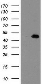 AIPL1 Antibody in Western Blot (WB)