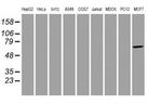 AIPL1 Antibody in Western Blot (WB)