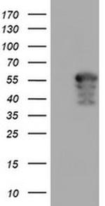 AIPL1 Antibody in Western Blot (WB)