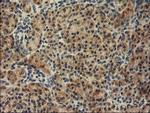 TBC1D21 Antibody in Immunohistochemistry (Paraffin) (IHC (P))