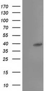 TBC1D21 Antibody in Western Blot (WB)