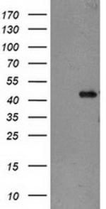 TBC1D21 Antibody in Western Blot (WB)