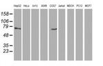 TBC1D21 Antibody in Western Blot (WB)