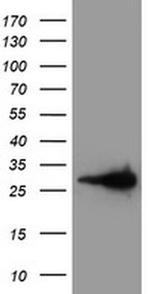 Latexin Antibody in Western Blot (WB)