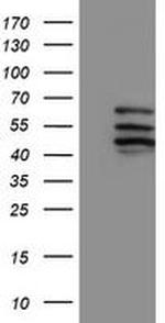 CYP2C9 Antibody in Western Blot (WB)