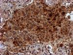 HARS2 Antibody in Immunohistochemistry (Paraffin) (IHC (P))