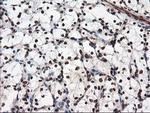 NUDT18 Antibody in Immunohistochemistry (Paraffin) (IHC (P))