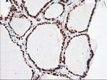 NUDT18 Antibody in Immunohistochemistry (Paraffin) (IHC (P))