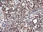 NUDT18 Antibody in Immunohistochemistry (Paraffin) (IHC (P))