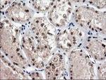 NUDT18 Antibody in Immunohistochemistry (Paraffin) (IHC (P))