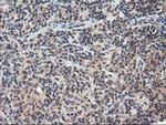 NUDT18 Antibody in Immunohistochemistry (Paraffin) (IHC (P))