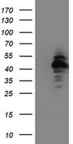 NAPE PLD Antibody in Western Blot (WB)