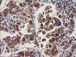 HARS2 Antibody in Immunohistochemistry (Paraffin) (IHC (P))