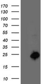 CENPH Antibody in Western Blot (WB)