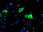 CENPH Antibody in Immunocytochemistry (ICC/IF)