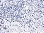 SERPINB2 Antibody in Immunohistochemistry (Paraffin) (IHC (P))