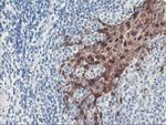 SERPINB2 Antibody in Immunohistochemistry (Paraffin) (IHC (P))