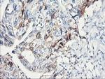 SERPINB2 Antibody in Immunohistochemistry (Paraffin) (IHC (P))