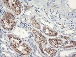 SERPINB2 Antibody in Immunohistochemistry (Paraffin) (IHC (P))