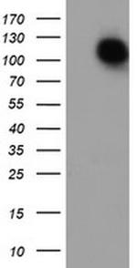 CD249 Antibody in Western Blot (WB)