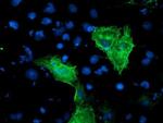 KVbeta1 (KCNAB1) Antibody in Immunocytochemistry (ICC/IF)