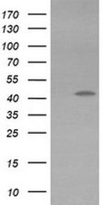 KVbeta1 (KCNAB1) Antibody in Western Blot (WB)