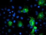 PFKP Antibody in Immunocytochemistry (ICC/IF)