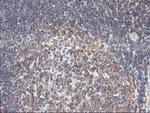 PFKP Antibody in Immunohistochemistry (Paraffin) (IHC (P))