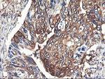 PFKP Antibody in Immunohistochemistry (Paraffin) (IHC (P))