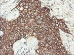 PFKP Antibody in Immunohistochemistry (Paraffin) (IHC (P))