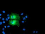 PFKP Antibody in Immunocytochemistry (ICC/IF)