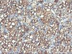 PFKP Antibody in Immunohistochemistry (Paraffin) (IHC (P))